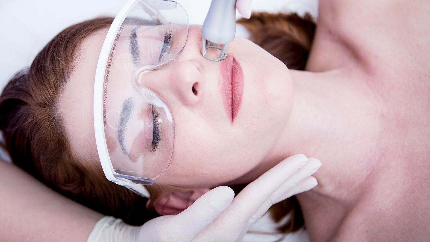 Laser Skin Rejuvenation